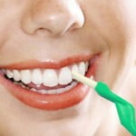 Tẩy trắng răng có làm răng ê buốt không?