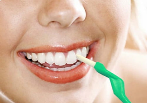 Tẩy trắng răng có làm răng ê buốt không?