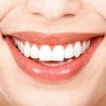 Cách làm răng trắng răng bằng công nghệ laser