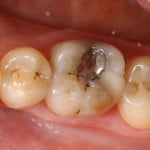 Những vấn đề răng miệng cần được điều trị
