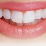 Răng sứ có bị đổi màu không?