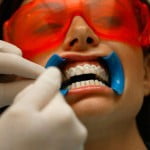 Phương pháp tẩy trắng răng tiết kiệm chi phí
