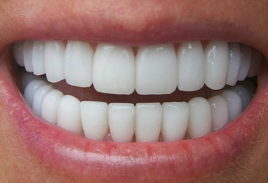 Bọc răng sứ buộc phải xâm lấn răng