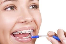 Đánh răng đúng cách sẽ giúp giảm đau hiệu quả khi niềng răng