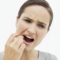 bệnh viêm chân răng là gì