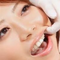 Cách trị sưng nướu răng