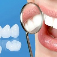 Làm răng sứ có niềng răng được không? Có bền không?