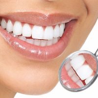 Bọc răng sứ có ảnh hưởng gì không? Cần làm gì?