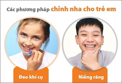 Niềng răng cho trẻ 10 tuổi có tốt không? 4