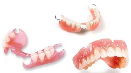 Trồng răng giả mất bao lâu với từng phương pháp? 2