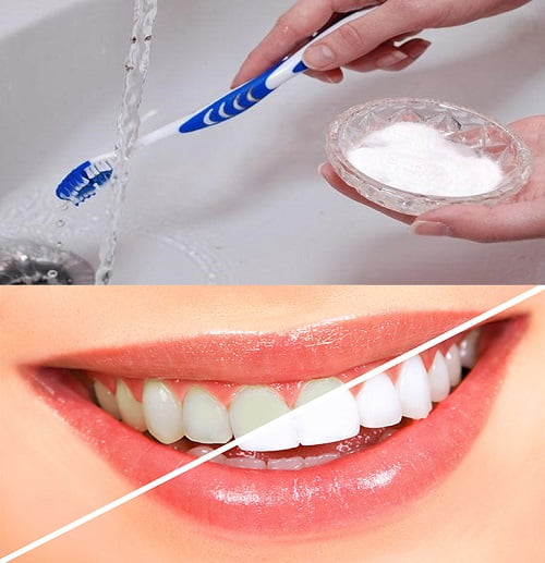 Cách tẩy trắng răng bị ố vàng tại nhà cho bạn 1